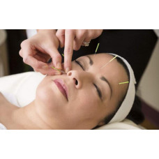 Cosmetic Acupuncture 针灸美容